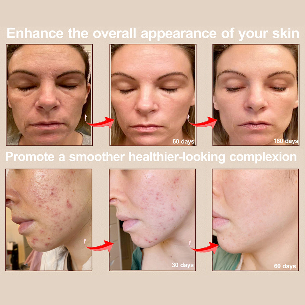 RadiancePro™ Mask
